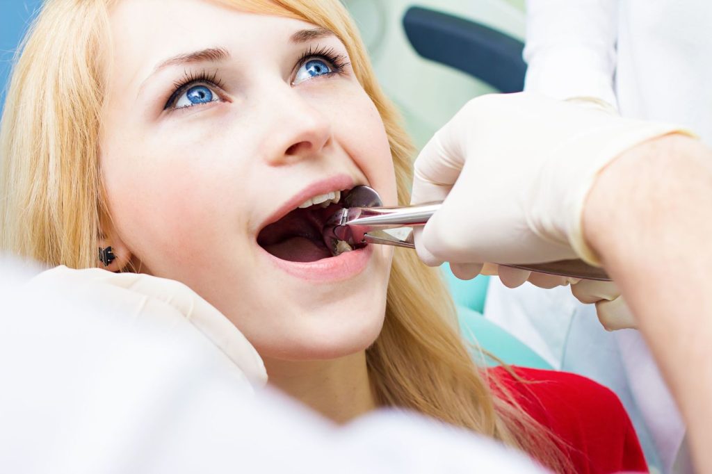 wisdom tooth removal singapore